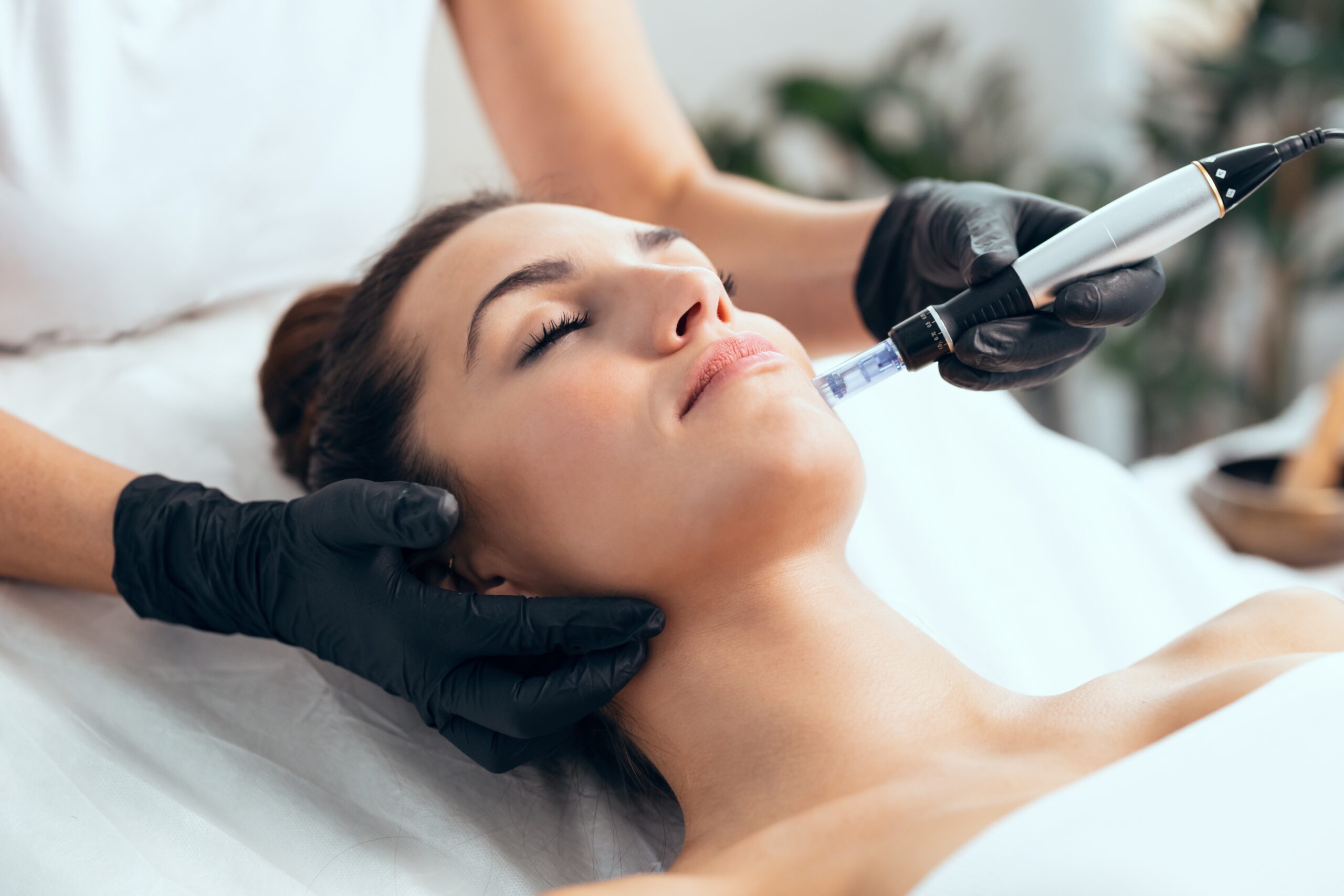 Woman receiving a microneedling facial treatment, with a skincare professional using a device on her face, promoting skin rejuvenation and collagen production in a serene spa environment.